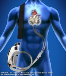 SynCardia, artificial heart, Total Artificial Heart, Freedom driver, donor heart, heart failure, heart transplant
